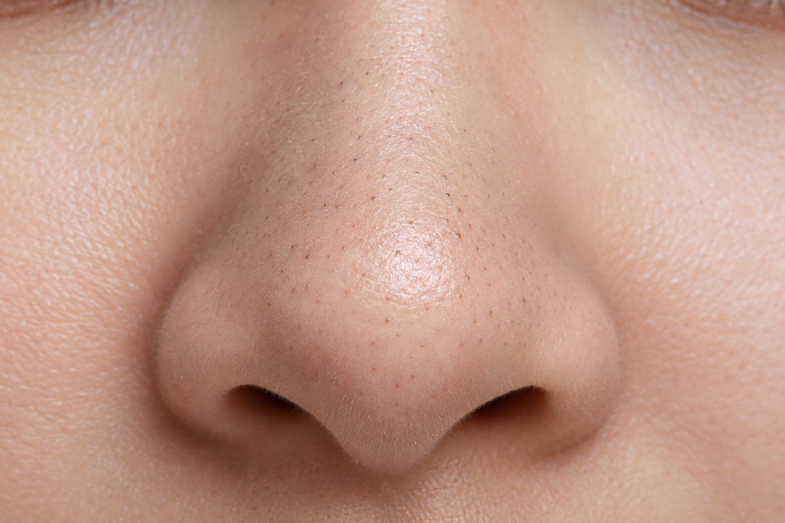 Close-up of a nose with small dark dots visible across its surface.